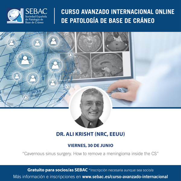 Curso Avanzado Internacional Online de Patología de Base de Cráneo – 6ª Sesión